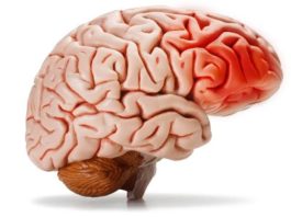 5 Foods That Damage Your Brain