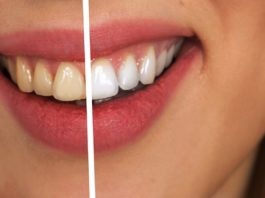 How To Whiten Your Teeth at Home