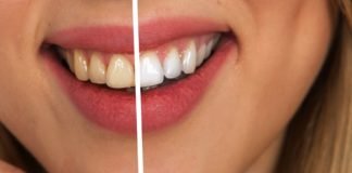 How To Whiten Your Teeth at Home How To Whiten Your Teeth at Home